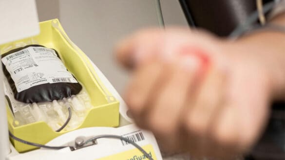 Un primer plano de un procedimiento de plasmaféresis muestra una bolsa de sangre llenándose de sangre mientras una persona aprieta el puño, destacando cómo este proceso puede ayudar a eliminar los microplásticos del cuerpo.